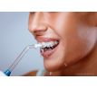Ústní sprcha ORAL IRRIGATOR SYSTEMAT